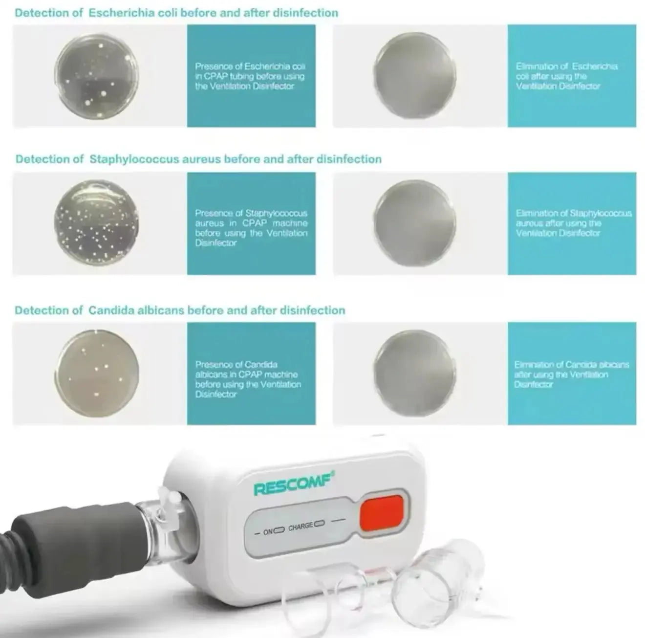 Portable Ozone Cleaning device model XD100 for disinfecting CPAP mask and tubes - SelfiMed UK